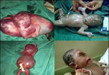 Neugeborene im Irak